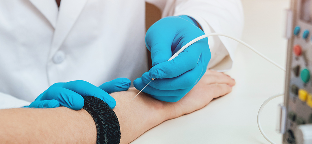 Understanding Surface EMG and High-Density Surface EMG