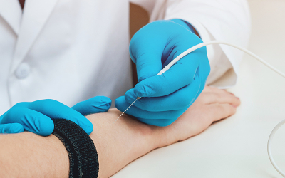 Understanding Surface EMG and High-Density Surface EMG